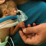 Недоносено дете