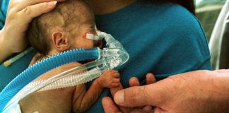 Недоносено дете