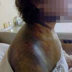 Майката на Людмила е пострадала тежко. Снимка: Людмила Илиева