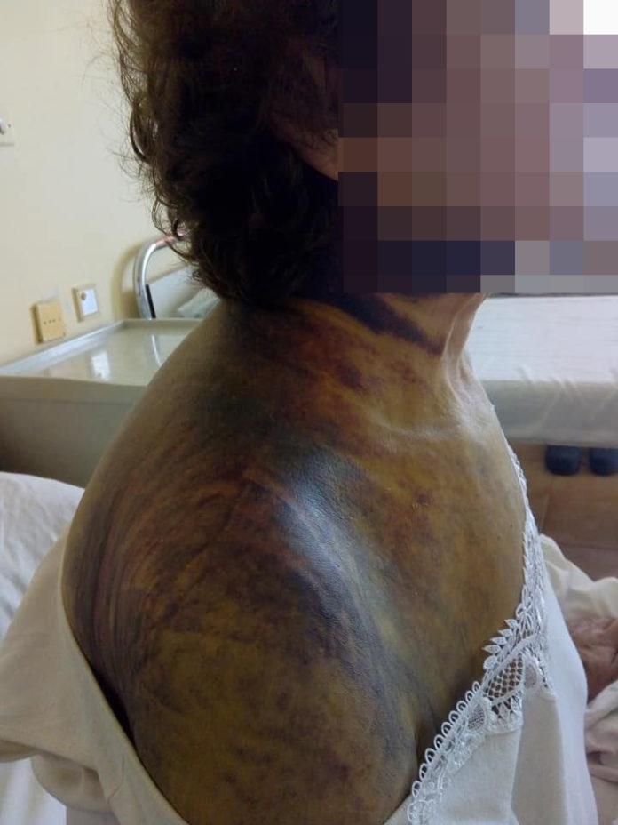 Майката на Людмила е пострадала тежко. Снимка: Людмила Илиева