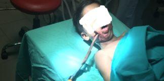 Дете с ножица в главата