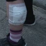 Пострадала