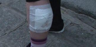 Пострадала