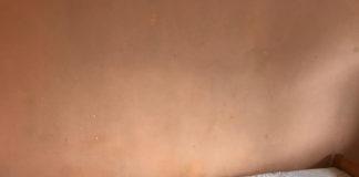 Лоши условия