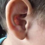 Ухото на Васко