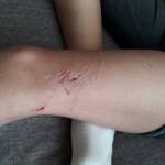 Нападнато дете