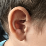 Насинено ухо