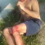 Блъснат човек, Слънчев бряг