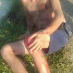 Блъснат човек, Слънчев бряг