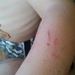 Нахапано дете