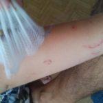 Нахапано дете