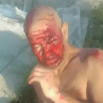 Блъснат човек, Слънчев бряг