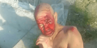 Блъснат човек, Слънчев бряг