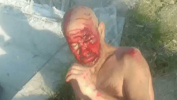 Блъснат човек, Слънчев бряг