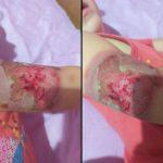 Пострадало дете