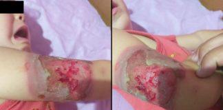 Пострадало дете