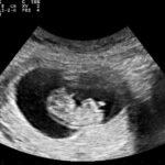 Снимка: Nevit Dilmen/Wikimedia Commons