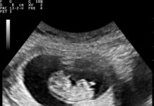 Снимка: Nevit Dilmen/Wikimedia Commons