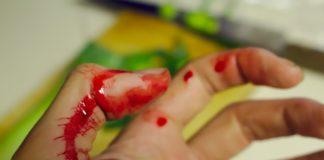 Илюстративна снимка: Пиксабей