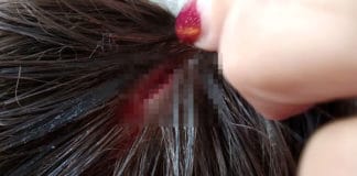 Раната. Снимка: Фейсбук, Nadya Bulatova‎