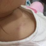 Синините на детето от Ловеч