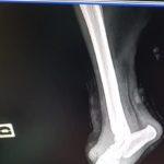 Снимки на отрязаните крайници