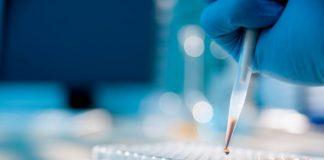 Кръвна проба