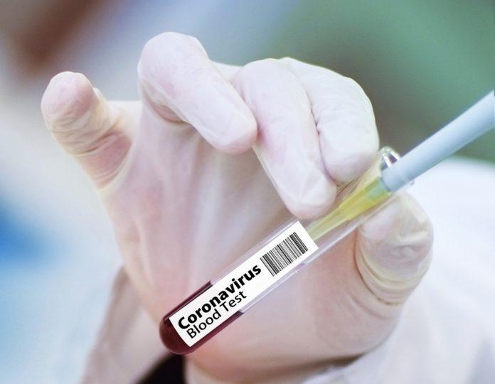 тестове, коронавирус, covid-19