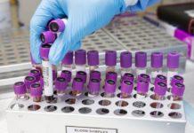 Кръвни проби