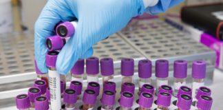 Кръвни проби