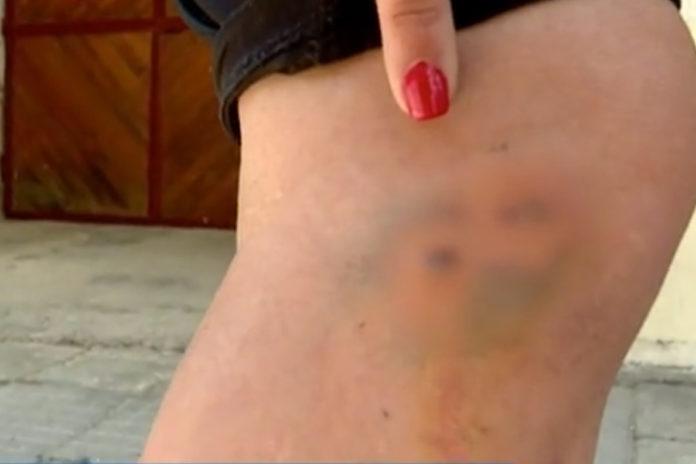 Пострадала жена