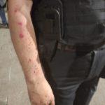 Ранен полицай. Снимка: МВР, архив