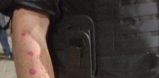 Ранен полицай. Снимка: МВР, архив