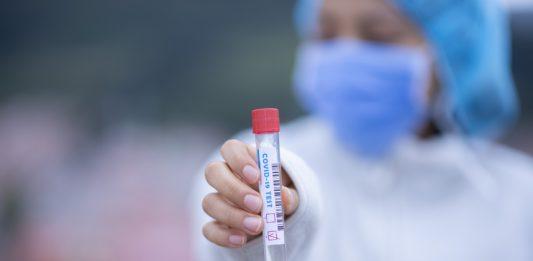 Тест за коронавирус.