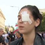 Ранена жена на протеста