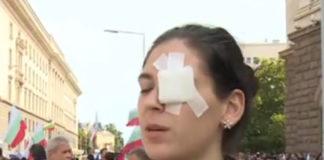 Ранена жена на протеста