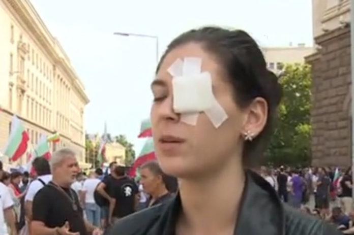 Ранена жена на протеста
