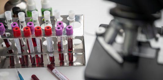 Ваксина/коронавирус/изследвания