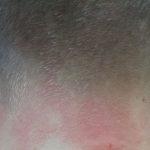 Дете с наранявания