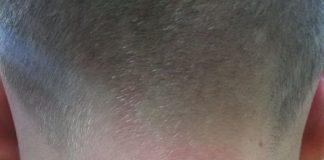 Дете с наранявания