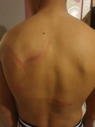 Пребито момче