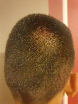 Пребито момче