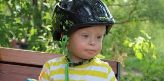 Синдром на Даун