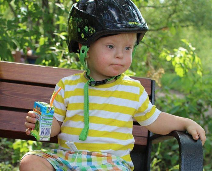 Синдром на Даун