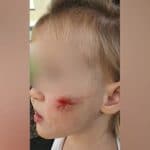 Пострадало дете