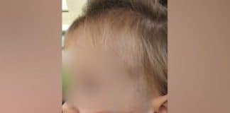 Пострадало дете