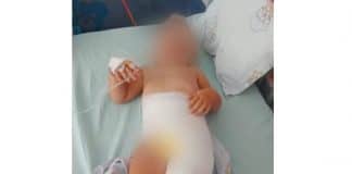 Пострадало дете