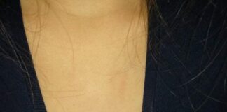 Пострадало дете