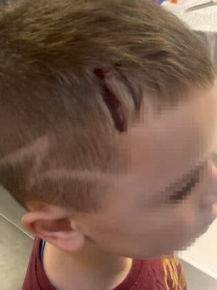 Ударено дете