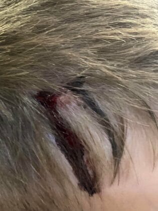 Ударено дете